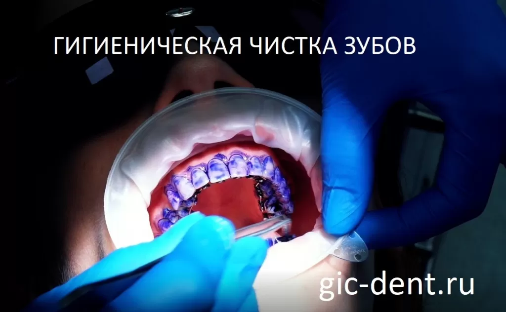 Елена Захарова врач-гигиенист проводит обработку зубов